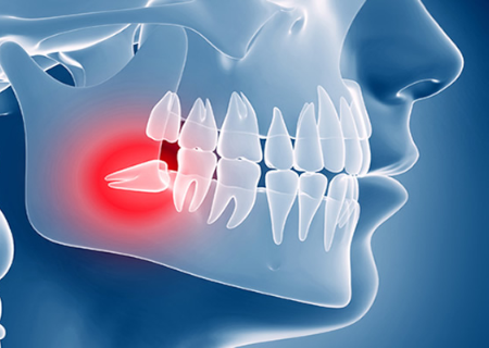 cirugia oral
